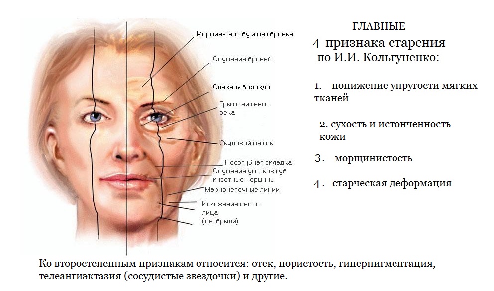 Косметолог консультация "Типы старения кожи"